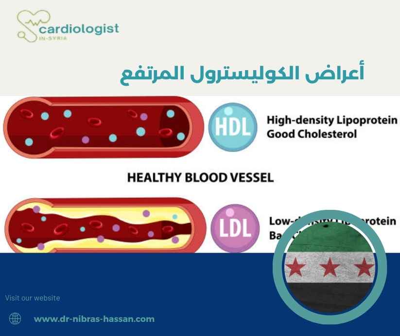 أعراض الكوليسترول المرتفع أعراض الكوليسترول المرتفع