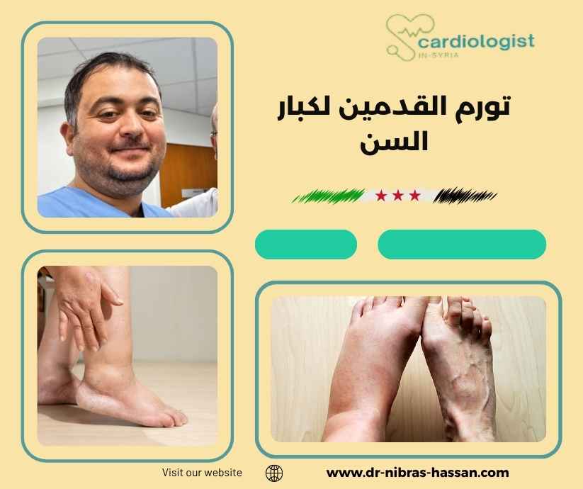 تورم القدمين لكبار السن