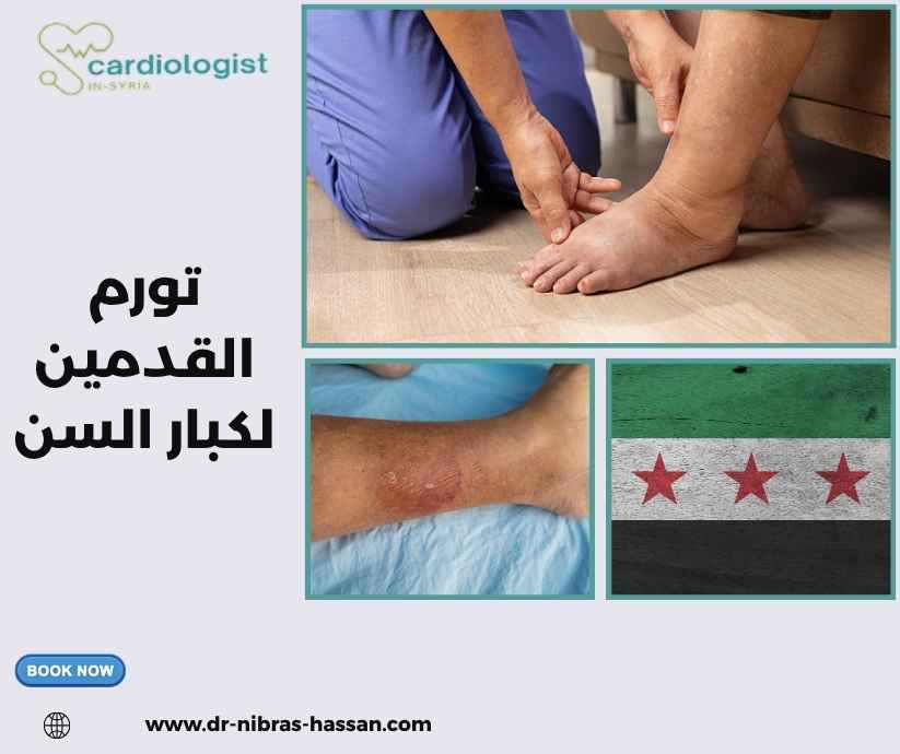 تورم القدمين لكبار السن