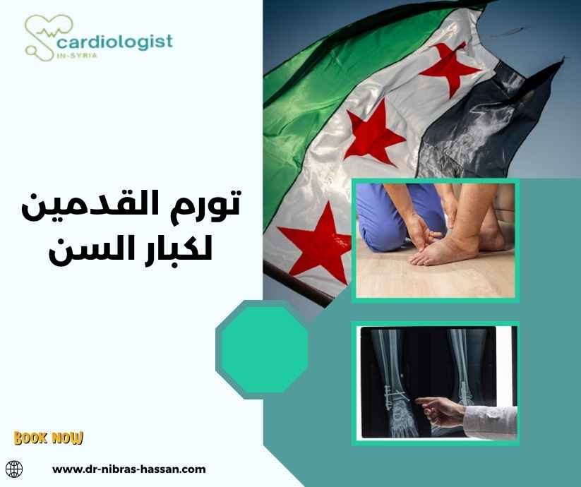 تورم القدمين لكبار السن