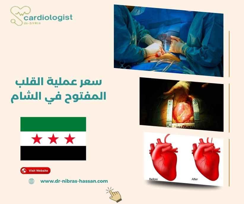 سعر عملية القلب المفتوح في الشام